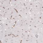 Anti-LAMA2 Antibody