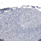 Anti-LAMA2 Antibody