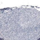Immunohistochemical staining of human tonsil shows no positivity in lymphoid cells as expected.