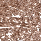 Immunohistochemical staining of rat heart muscle shows strong membranous positivity in cardiomyocytes.