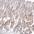 Anti-LAMA2 Antibody