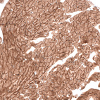 Immunohistochemical staining of mouse heart muscle shows strong membranous positivity in cardiomyocytes.
