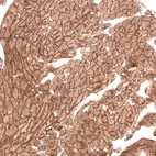 Immunohistochemical staining of mouse heart muscle shows strong membranous positivity in cardiomyocytes.