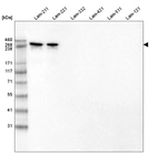 Western blot analysis of purified human recombinant Laminin-211, Laminin-221, Laminin-332, Laminin-421, Laminin-511 and Laminin-121.