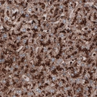 Immunohistochemical staining of human liver shows strong granular cytoplasmic positivity in hepatocytes.