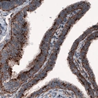 Immunohistochemical staining of human fallopian tube shows granular cytoplasmic immunoreactivity in epithelial cells.