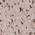 Immunohistochemical staining of human cerebral cortex shows strong granular cytoplasmic positivity in neurons.
