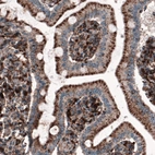 Immunohistochemical staining of human small intestine shows granular cytoplasmic immunoreactivity in glandular cells.