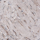 Immunohistochemical staining of human skeletal muscle shows only very low cytoplasmic immunoreactivity.