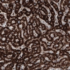 Immunohistochemical staining of human liver shows strong cytoplasmic positivity in hepatocytes.