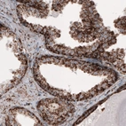 Immunohistochemical staining of human prostate shows strong cytoplasmic immunoreactivity in epithelial cells.