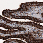 Immunohistochemical staining of human fallopian tube shows strong cytoplasmic positivity in epithelial cells.