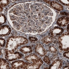 Immunohistochemical staining of human kidney shows strong cytoplasmic positivity in renal tubules cells.