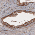 Immunohistochemical staining of human prostate shows cytoplasmic positivity in the epithelial cells.