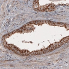 Immunohistochemical staining of human prostate shows cytoplasmic positivity in the epithelial cells.