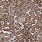 Immunohistochemical staining of human liver shows cytoplasmic immunoreactivity in hepatocytes.