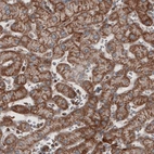 Immunohistochemical staining of human liver shows cytoplasmic immunoreactivity in hepatocytes.