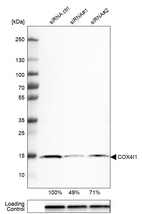 Western blot analysis in U-251MG cells transfected with control siRNA, target specific siRNA probe #1 and #2, using Anti-COX4I1 antibody. Remaining relative intensity is presented. Loading control: Anti-GAPDH.