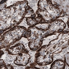 Immunohistochemical staining of human placenta shows strong cytoplasmic immunoreactivity in trophoblasts.
