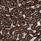 Immunohistochemical staining of human liver shows strong cytoplasmic positivity in hepatocytes.