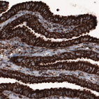 Immunohistochemical staining of human fallopian tube shows strong cytoplasmic immunoreactivity in epithelial cells.