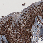 Immunohistochemical staining of human skin shows strong cytoplasmic immunoreactivity in epithelial cells.