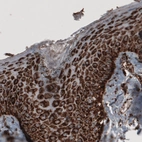 Immunohistochemical staining of human skin shows strong cytoplasmic immunoreactivity in epithelial cells.