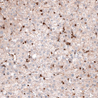 Immunohistochemical staining of human liver shows strong cytoplasmic positivity in leukocytes.