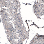 Immunohistochemical staining of human testis shows very weak cytoplasmic positivity in cells in seminiferous ducts.