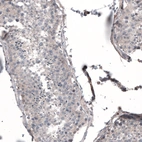 Immunohistochemical staining of human testis shows very weak cytoplasmic positivity in cells in seminiferous ducts.