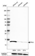 Anti-PFN1 Antibody