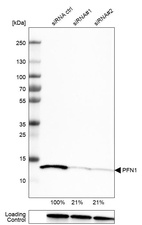 Western blot analysis in U-251MG cells transfected with control siRNA, target specific siRNA probe #1 and #2, using Anti-PFN1 antibody. Remaining relative intensity is presented. Loading control: Anti-GAPDH.