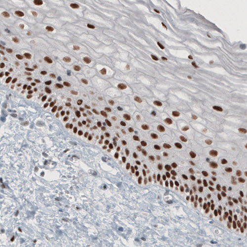 Anti-TLE3 Antibody