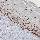Anti-TLE3 Antibody