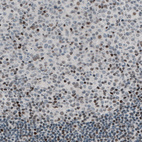 Immunohistochemical staining of human tonsil shows nuclear immunoreactivity in a subset of lymphoid cells.