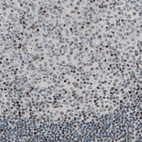 Immunohistochemical staining of human tonsil shows nuclear immunoreactivity in a subset of lymphoid cells.