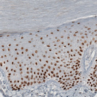 Immunohistochemical staining of human oral mucosa shows strong nuclear positivity in epithelial cells.