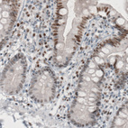 Immunohistochemical staining of human small intestine shows moderate nuclear immunoreactivity in glandular epithelium cells.