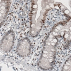 Immunohistochemical staining of human small intestine shows moderate nuclear immunoreactivity in glandular epithelium cells.