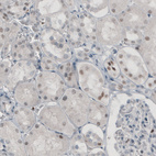 Anti-TLE3 Antibody