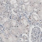 Immunohistochemical staining of human kidney shows weak to moderate nuclear positivity in a subset of cells.