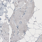 Immunohistochemical staining of human skeletal muscle shows absence of immunoreactivity (negative control).
