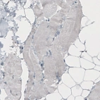 Immunohistochemical staining of human skeletal muscle shows absence of immunoreactivity (negative control).