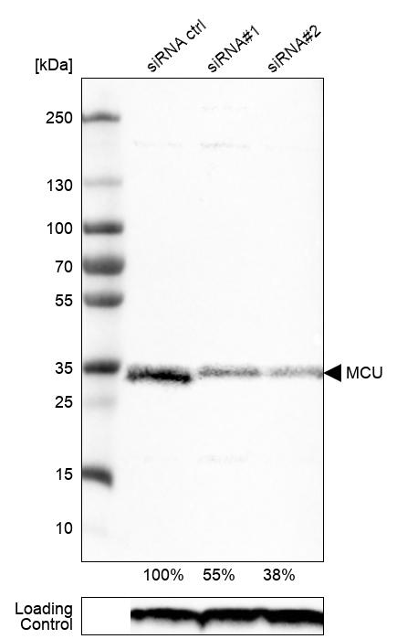 Anti-MCU Antibody