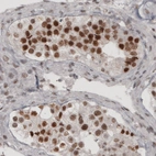 Immunohistochemical staining of human testis shows nuclear immunoreactivity in seminiferous tubules cells.