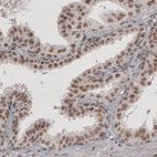 Immunohistochemical staining of human prostate shows moderate nuclear positivity in glandular cells.