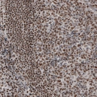 Immunohistochemical staining of human tonsil shows nuclear immunoreactivity in lymphoid cells.