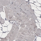 Immunohistochemical staining of human skeletal muscle shows absence of immunoreactivity (negative control).