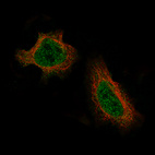 Immunofluorescence staining of HeLa cells using the Anti-DAXX monoclonal antibody, showing specific staining in the nucleoplasm and cytosol in green. Microtubule- and nuclear probes are visualized in red and blue, respectively (where available).