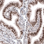 Anti-ARID1A Antibody
